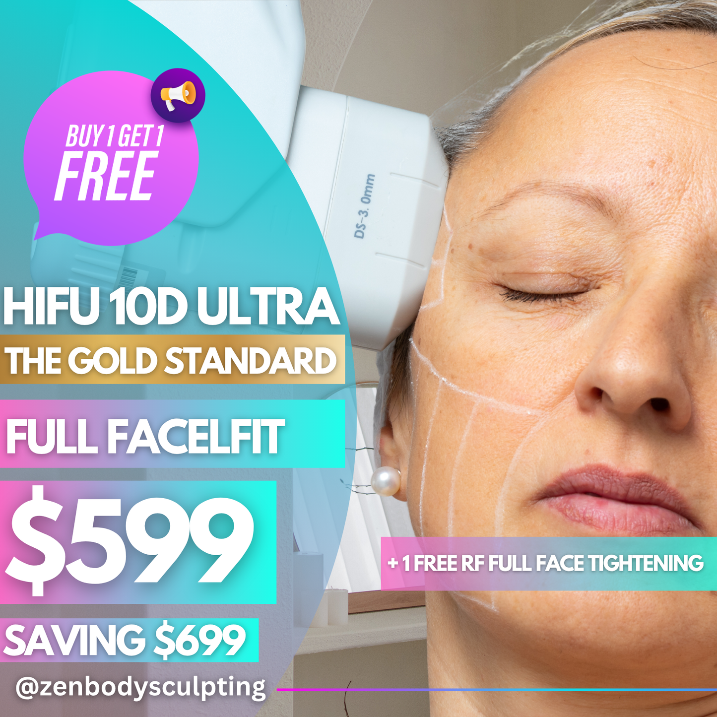 HIFU 10D ULTRA - 2 SESSIONS OF FULL FACELIFT