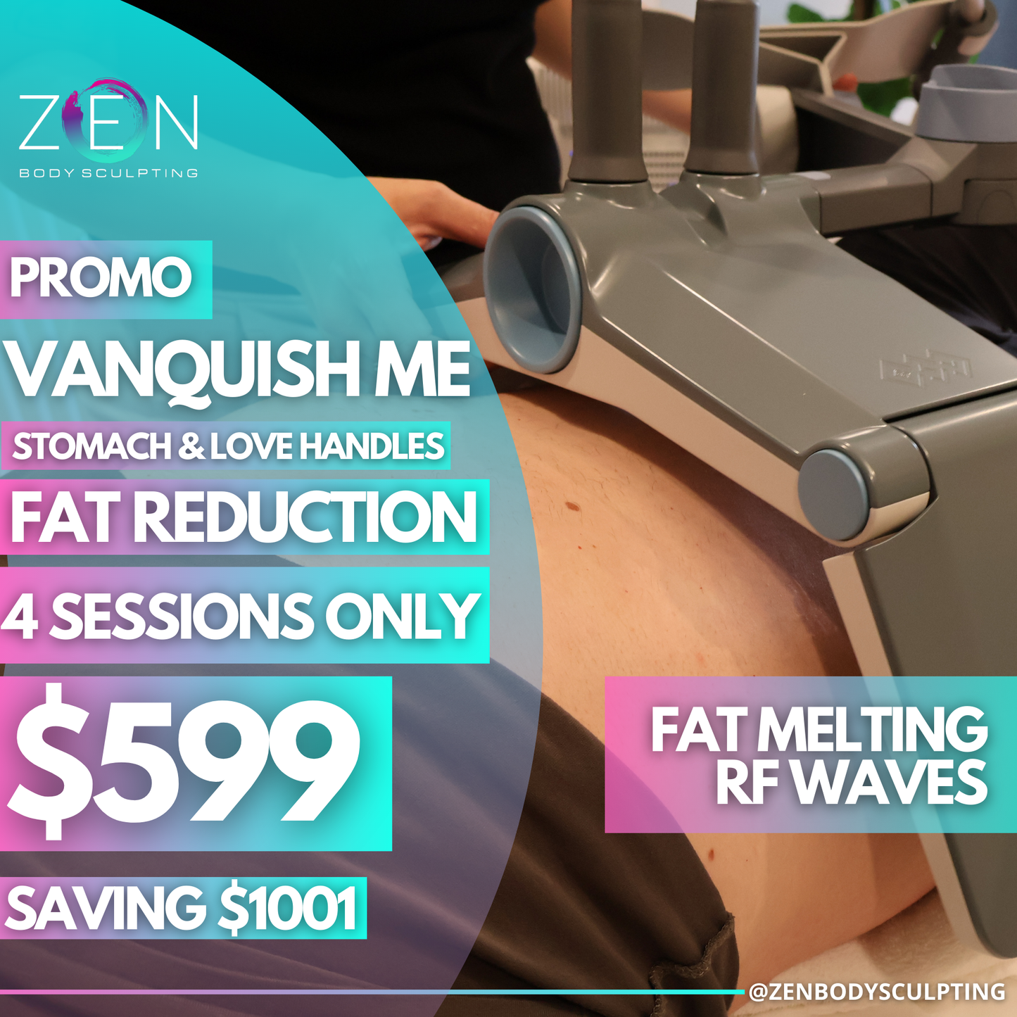 4 SESSIONS OF VANQUISH ME - FAT REDUCTION