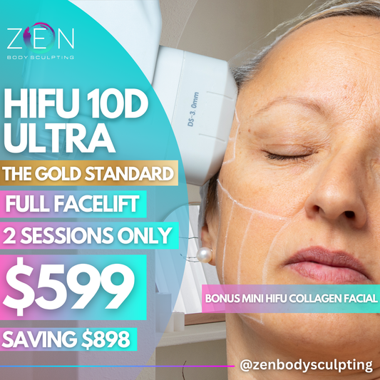 HIFU 10D ULTRA -  2 SESSIONS OF FULL FACELIFT