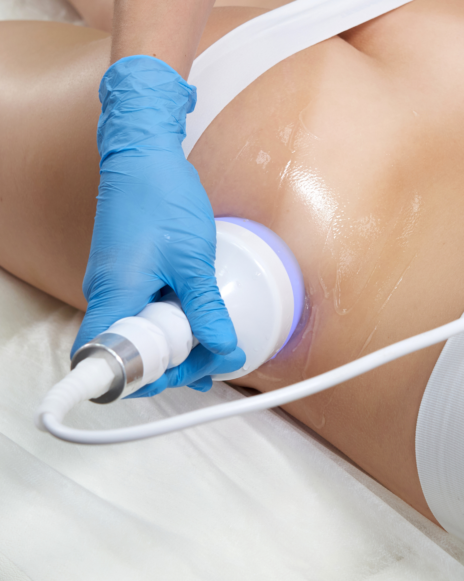 Fat Cavitation